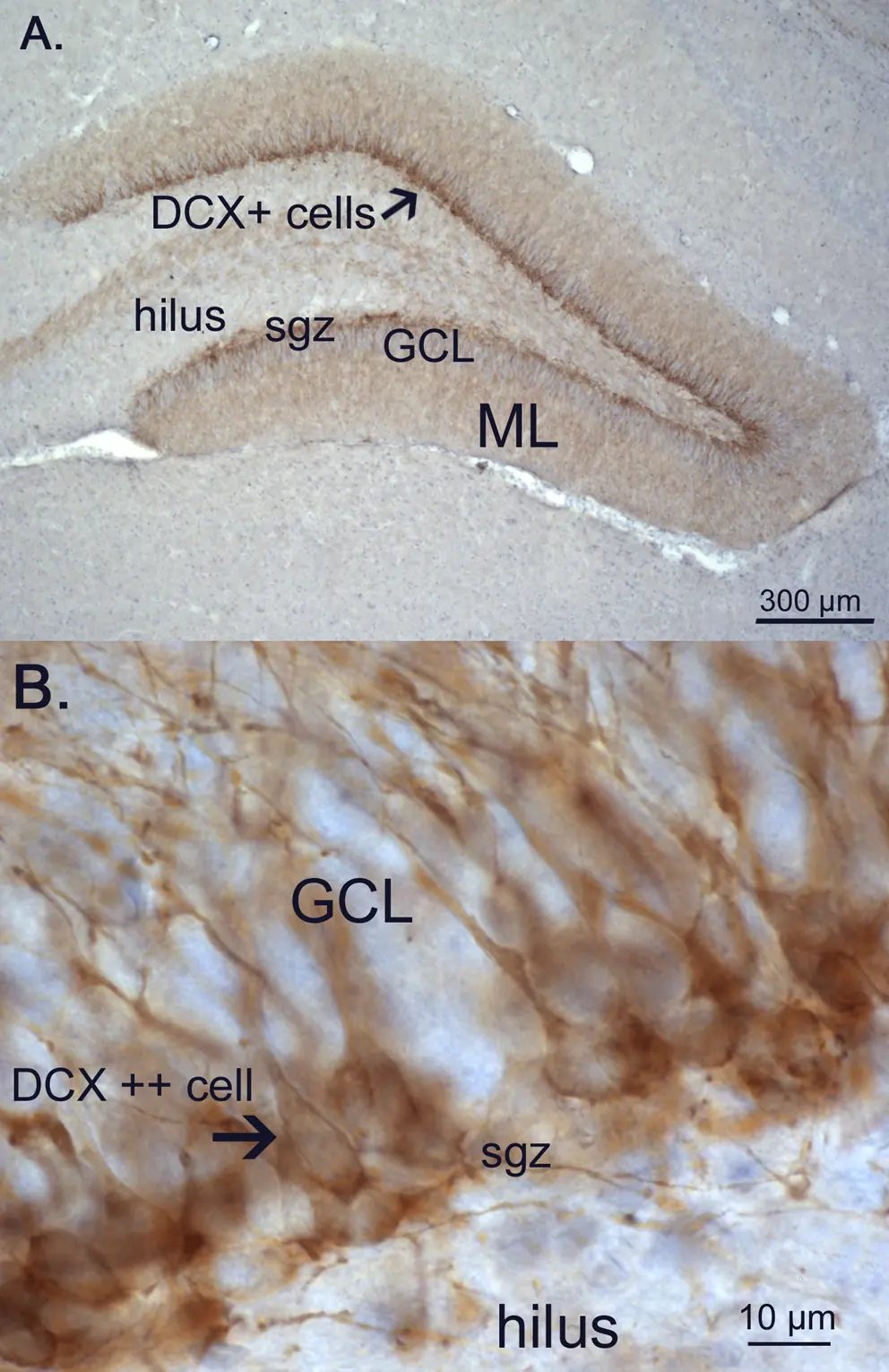 해마 치상회를 더블코르틴(DCX) 항체로 염색한 현미경 사진. 갈색으로 물든 새 신경세포가 과립세포층 안쪽에 띠를 이루고 있습니다