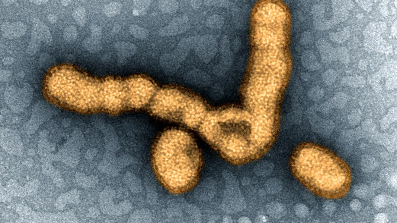 컬러 처리된 투과전자현미경 사진 속 H1N1 인플루엔자 바이러스 입자들