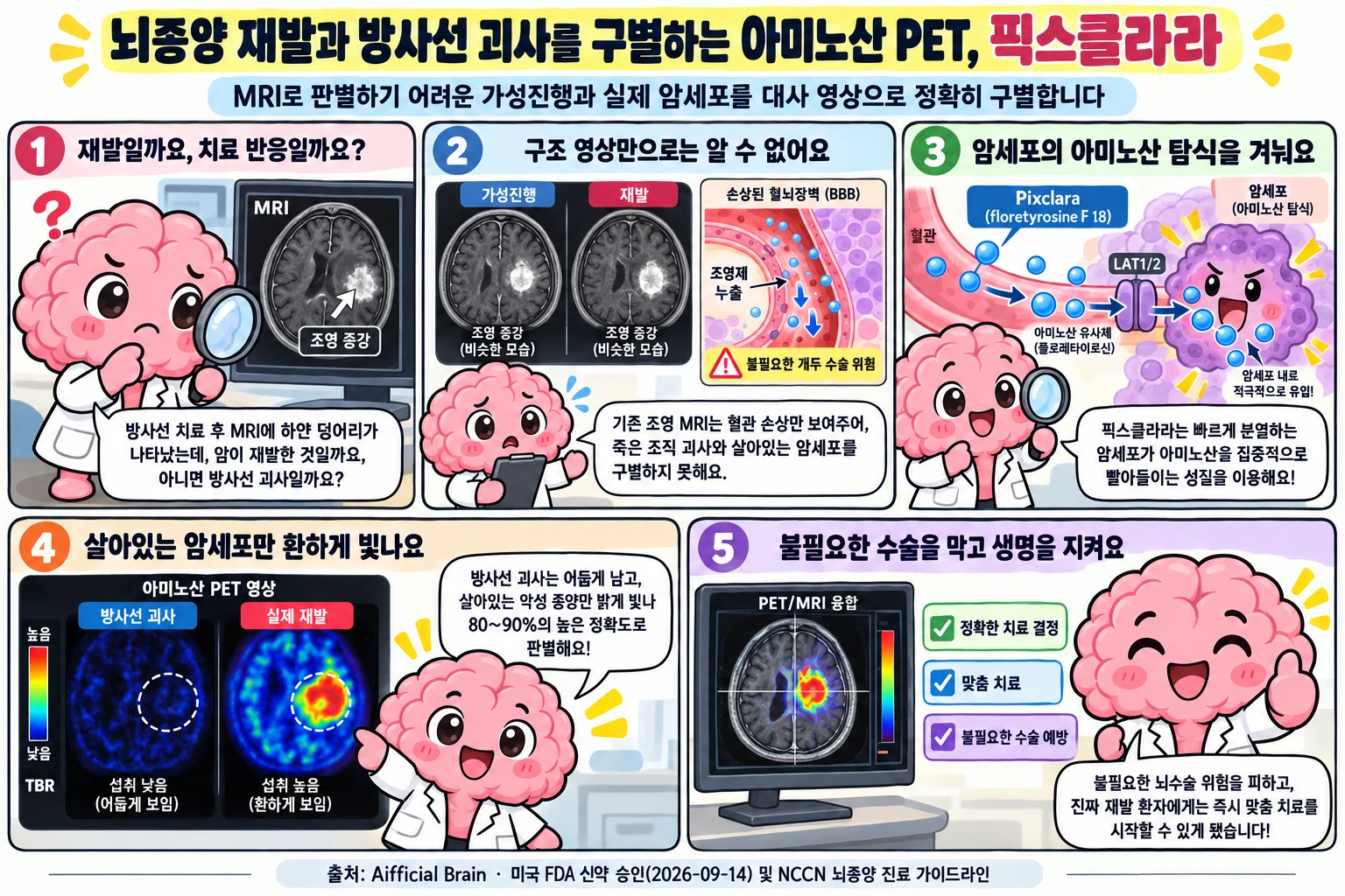Brain 박사가 뇌종양 치료 후 MRI 한계와 픽스클라라 아미노산 PET의 감별 원리를 설명하는 캐릭터 학습만화
